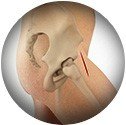 Outpatient Direct Anterior Hip Replacement service